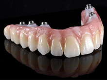 Zirconia Bridge